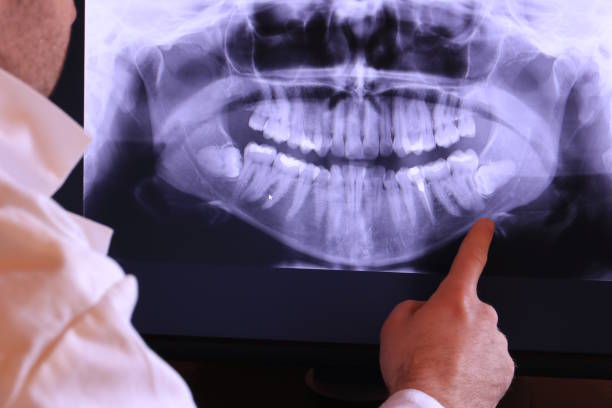 Best Cracked Tooth Emergency Dentist  in Goodhue, MN